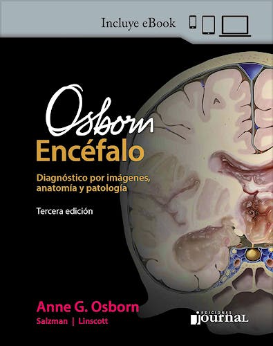 Portada del libro 9789878452951 OSBORN Encéfalo. Diagnóstico por Imágenes, Anatomía y Patología