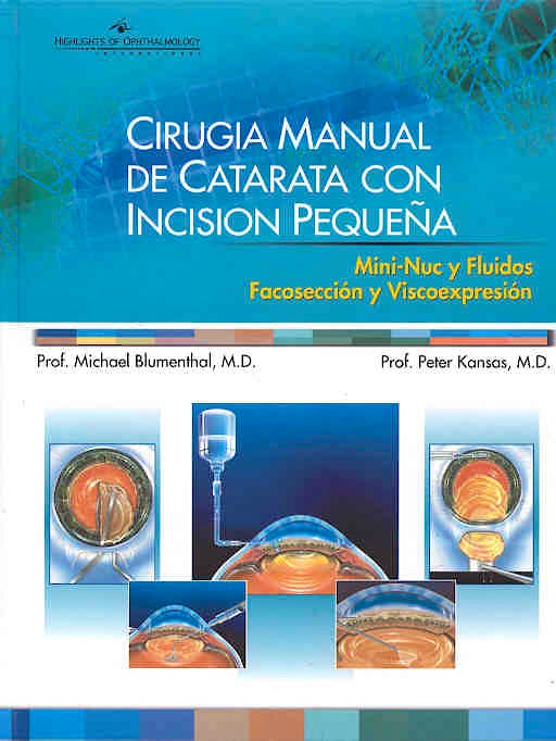 Portada del libro 9789962613251 Cirugia Manual de Catarata con Incision Pequeña. Mini-Nuc y Fluidos. Facoseccion y Viscoexpresion