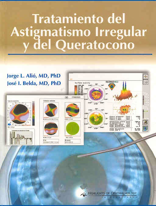 Portada del libro 9789962613299 Tratamiento del Astigmatismo Irregular y del Queratocono