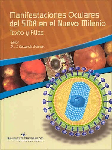 Portada del libro 9789962613336 Manifestaciones Oculares del Sida en el Nuevo Milenio. Texto y Atlas