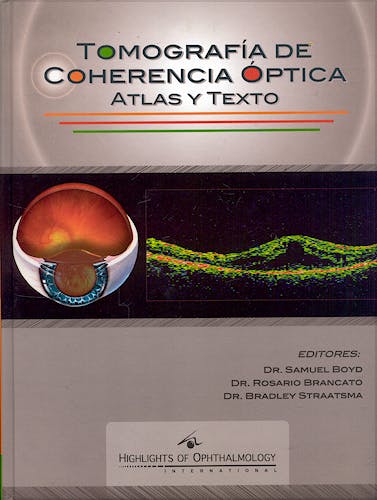 Portada del libro 9789962613497 Tomografia de Coherencia Optica. Atlas y Texto