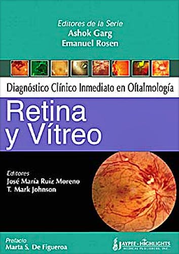 Portada del libro 9789962678199 Retina y Vítreo (Diagnóstico Clínico Inmediato en Oftalmología)