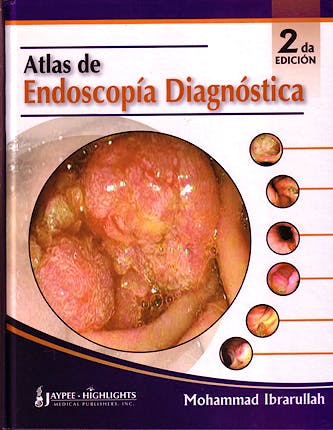 Portada del libro 9789962678298 Atlas de Endoscopía Diagnóstica