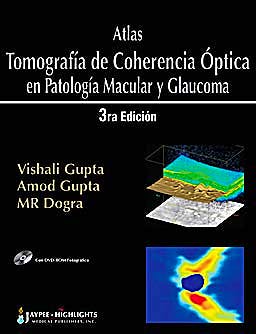 Portada del libro 9789962678304 Atlas Tomografía de Coherencia Óptica en Patología Macular y Glaucoma
