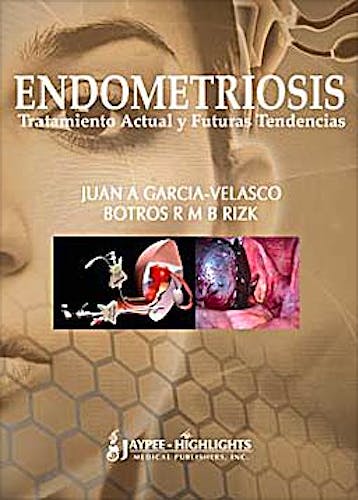 Portada del libro 9789962678397 Endometriosis. Tratamiento Actual y Futuras Tendencias