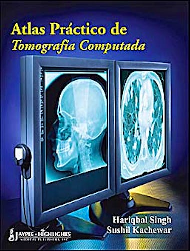 Portada del libro 9789962678427 Atlas Práctico de Tomografía Computada