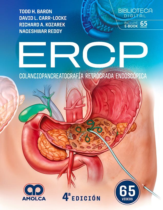 Portada del libro 9789962860426 ERCP. Colangiopancreatografía Retrógrada Endoscópica