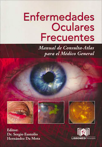 Portada del libro 9789962906100 Enfermedades Oculares Frecuentes. Manual de Consulta-Atlas para el Médico General