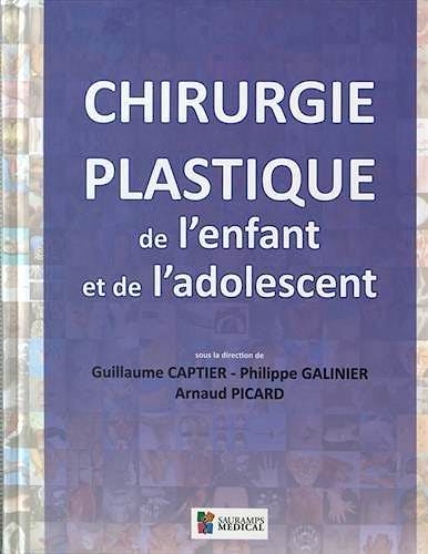 Portada del libro 9791030300208 Chirurgie Plastique de L'enfant Et de L'adolescent