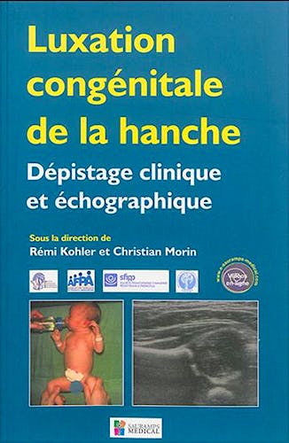 Portada del libro 9791030300246 Luxation Congenitale de la Hanche. Depistage Clinique Et Echographique