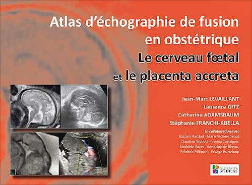 Portada del libro 9791030300369 Atlas d´Échographie de Fusion en Obstétrique. Le Cerveau Foetal et le Placenta Accreta