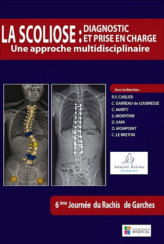 Portada del libro 9791030300390 La Scoliose: Diagnostic Et Prise en Charge. Une Approche Multidisciplinaire