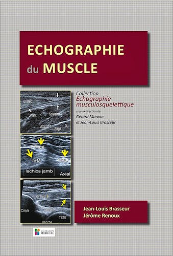 Portada del libro 9791030300499 Echographie Du Muscle
