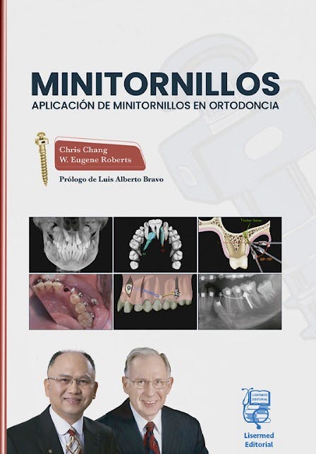 Portada del libro 9791399006025 MINITORNILLOS. Aplicación de Minitornillos en Ortodoncia