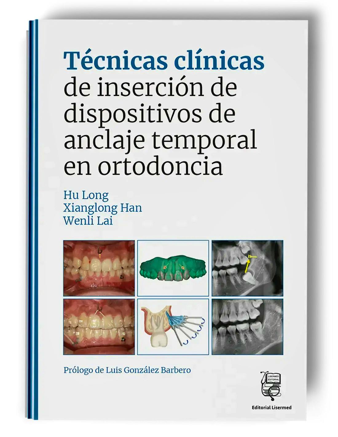 Portada del libro 9791399103397 Técnicas Clínicas de Dispositivos de Anclaje Temporal en Ortodoncia