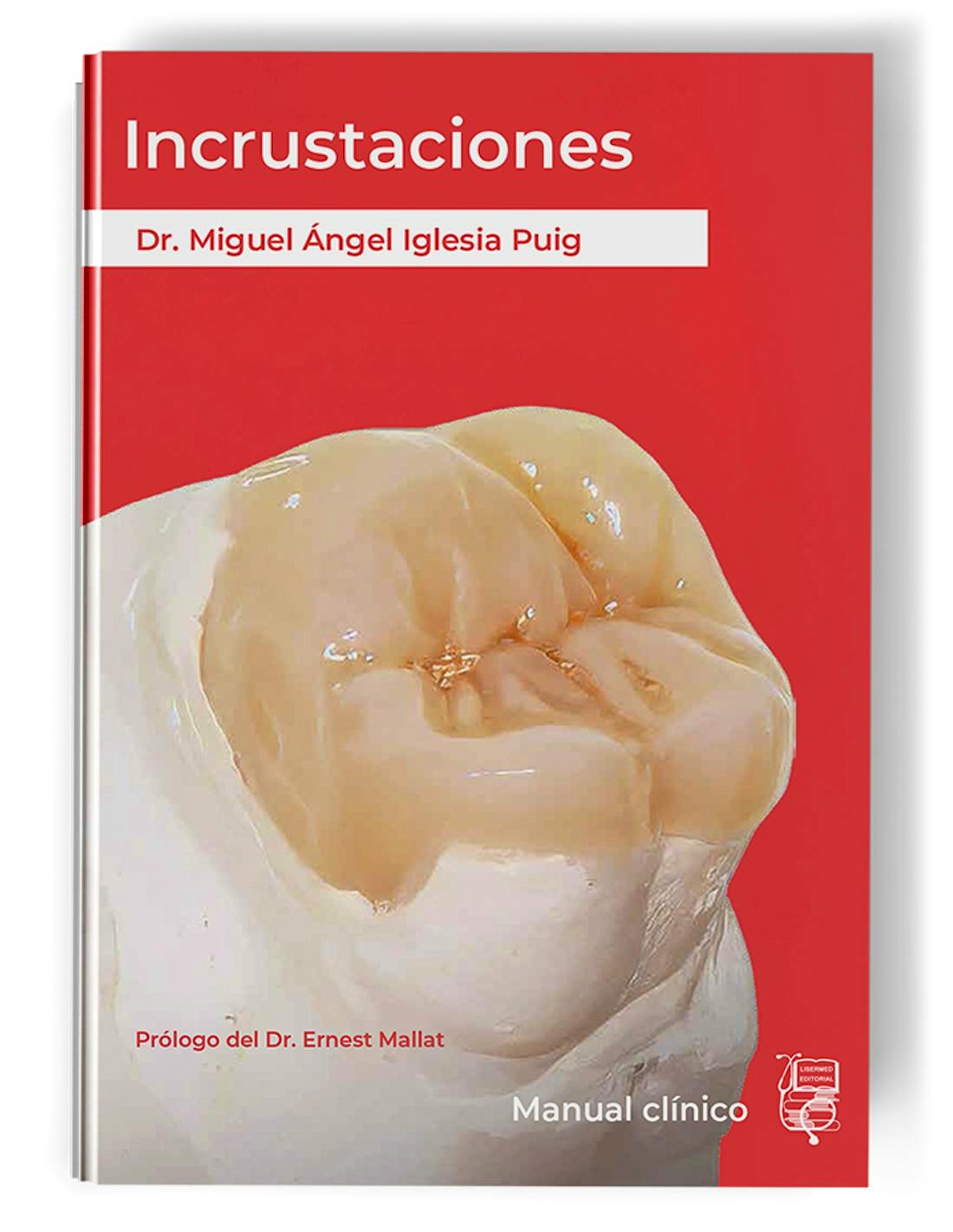 Portada del libro 9791399153088 Incrustaciones. Manual Clínico