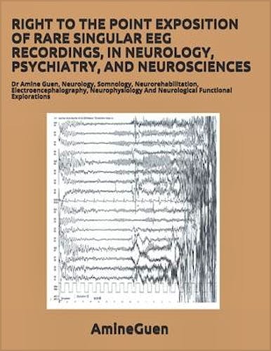 Portada del libro 9798729040124 Right to the Point Exposition of Rare Singular EEG Recordings, in Neurology, Psychiatry, and Neurosciences