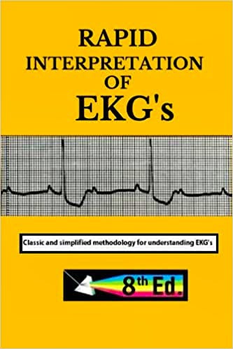 Portada del libro 9798759839651 Rapid Interpretation of EKG's