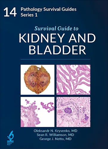Portada del libro 9798986743561 Survival Guide to Kidney and Bladder (Pathology Survival Guides Series 1, Vol. 14)